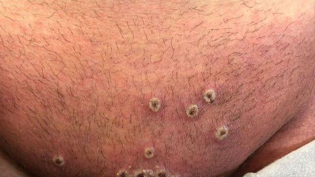 Viruela-Sismica-22-09-14-03